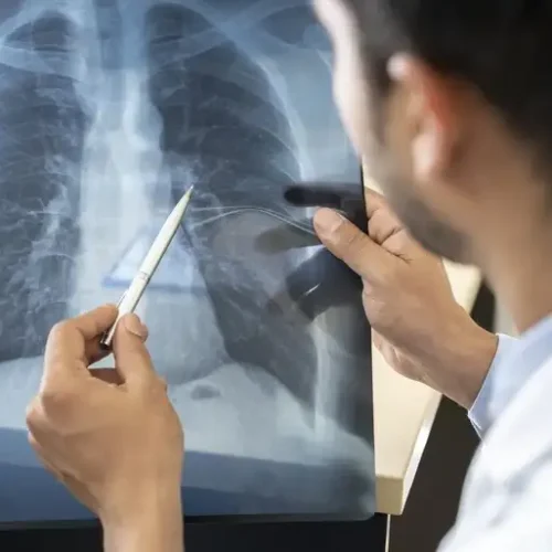 Tabagismo é maior entre jovens de 16 a 24 anos, alerta pesquisa